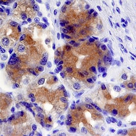 Immunohistochemistry Cytosolic Sulfotransferase 1C2/SULT1C2 Antibody (844529)