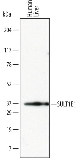 Western Blot Cytosolic Sulfotransferase 1E1/SULT1E1 Antibody (726211)