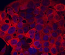 Immunocytochemistry Cytosolic Sulfotransferase 2A1/SULT2A1 Antibody