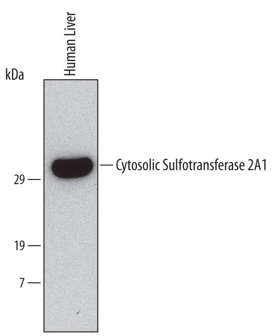 Western blot shows lysates of human liver tissue. PVDF Membrane was probed with 2 µg/mL of Mouse Anti-Human Cytosolic Sulfotransferase 2A1/ SULT2A1 Mono-clonal Antibody (Catalog # MAB5828) followed by HRP-conjugated Anti-Mouse IgG Secondary Antibody (Catalog # HAF007). A specific band was detected for Cytosolic Sulfotransferase 2A1/SULT2A1 at approximately 35 kDa (as indicated). This experiment was conducted under reducing conditions and using Immunoblot Buffer Group 1.