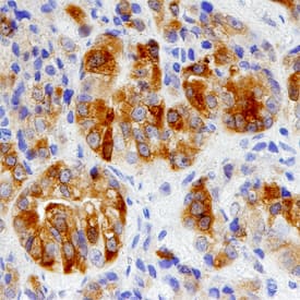 Immunohistochemistry Cytosolic Sulfotransferase 2B1/SULT2B1 Antibody