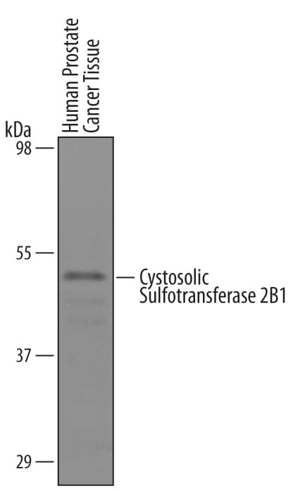 Western Blot Cytosolic Sulfotransferase 2B1/SULT2B1 Antibody