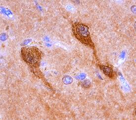 Immunohistochemistry Cytosolic Sulfotransferase 4A1/SULT4A1 Antibody (634630)