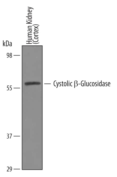 Western blot shows lysates of human kidney (cortex) tissue. PVDF Membrane was probed with 1 µg/mL of Sheep Anti-Human Cytosolic  beta -Glucosidase/GBA3 Antigen Affinity-purified Polyclonal Antibody (Catalog # AF5969) followed by HRP-conjugated Anti-Sheep IgG Secondary Antibody (Catalog # HAF016). A specific band was detected for Cytosolic  beta -Glucosidase/GBA3 at approximately 57 kDa (as indicated). This experiment was conducted under reducing conditions and using Immunoblot Buffer Group 1.