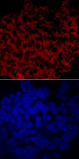 Cytosolic  beta -Glucosidase/GBA3 was detected in immersion fixed HeLa human cervical epithelial carcinoma cell line using Mouse Anti-Human Cytosolic  beta -Glucosidase/GBA3 Monoclonal Antibody (Catalog # MAB59691) at 10 µg/mL for 3 hours at room temperature. Cells were stained using the NorthernLights™ 557-conjugated Anti-Mouse IgG Secondary Antibody (red, upper panel; Catalog # NL007) and counterstained with DAPI (blue, lower panel). Specific staining was localized to cytoplasm. View our protocol for Fluorescent ICC Staining of Cells on Coverslips.