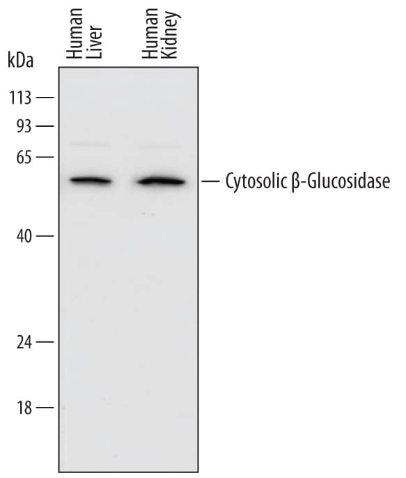 Western blot shows lysates of human liver tissue and human kidney tissue. PVDF membrane was probed with 1 µg/mL of Mouse Anti-Human Cytosolic  beta -Glucosidase/GBA3 Monoclonal Antibody (Catalog # MAB5969) followed by HRP-conjugated Anti-Mouse IgG Secondary Antibody (Catalog # HAF007). A specific band was detected for Cytosolic  beta -Glucosidase/GBA3 at approximately 53 kDa (as indicated). This experiment was conducted under reducing conditions and using Immunoblot Buffer Group 1.