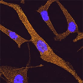 Immunocytochemistry DAB2 Antibody