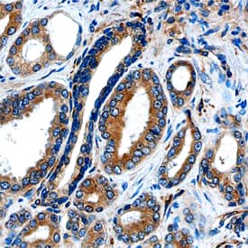 Immunohistochemistry DAB2 Antibody