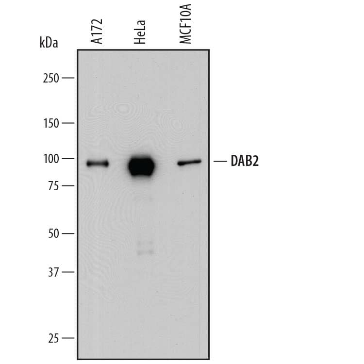 Western Blot DAB2 Antibody