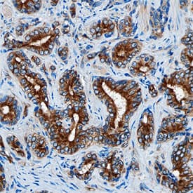 DAB2 was detected in immersion fixed paraffin-embedded sections of human prostate using Mouse Anti-Human DAB2 Monoclonal Antibody (Catalog # MAB8064) at 15 µg/mL overnight at 4 °C. Tissue was stained using the Anti-Mouse HRP-DAB Cell & Tissue Staining Kit (brown; Catalog # CTS002) and counterstained with hematoxylin (blue). Specific staining was localized to the cytoplasm of epithelial cells. View our protocol for Chromogenic IHC Staining of Paraffin-embedded Tissue Sections.