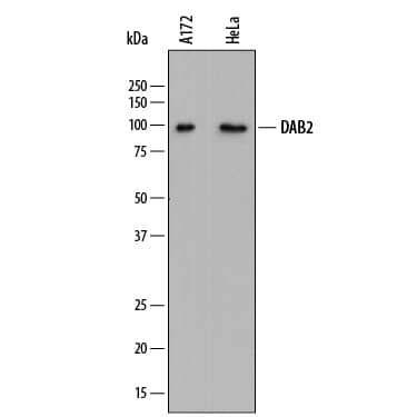Western blot shows lysates of A172 human glioblastoma cell line and HeLa human cervical epithelial carcinoma cell line. PVDF membrane was probed with 1 µg/mL of Mouse Anti-Human DAB2 Monoclonal Antibody (Catalog # MAB8064) followed by HRP-conjugated Anti-Mouse IgG Secondary Antibody (Catalog # HAF018). A specific band was detected for DAB2 at approximately 100 kDa (as indicated). This experiment was conducted under reducing conditions and using Immunoblot Buffer Group 1.