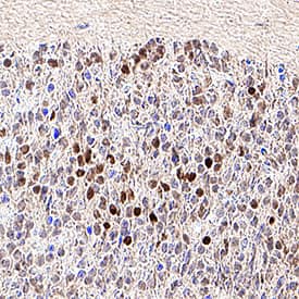 Immunohistochemistry DACH2 Antibody [Unconjugated]