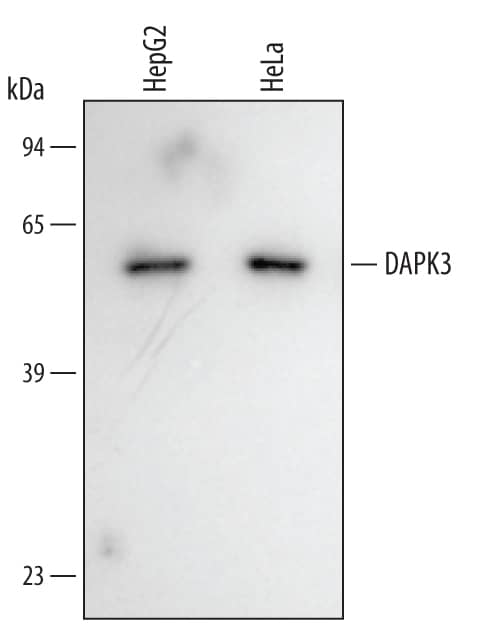 Western blot shows lysates of HepG2 human hepatocellular carcinoma cell line and HeLa human cervical epithelial carcinoma cell line. PVDF membrane was probed with 0.5 µg/mL of Human DAPK3/ZIPK Antigen Affinity-purified Polyclonal Antibody (Catalog # AF5290) followed by HRP-conjugated Anti-Goat IgG Secondary Antibody (Catalog # HAF109). A specific band was detected for DAPK3/ZIPK at approximately 52 kDa (as indicated). This experiment was conducted under reducing conditions and using Immunoblot Buffer Group 2.