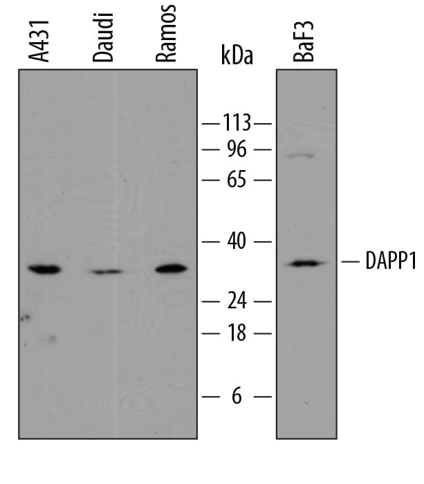 Western Blot DAPP1 Antibody