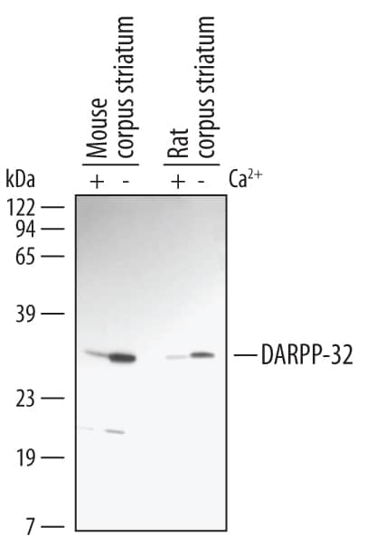 Western blot shows lysates of rat and mouse corpus striata tissue untreated (-) or treated (+) with calcium for 1 hour. PVDF membrane was probed with 1 µg/mL of Rabbit Anti-Mouse/Rat Phospho-DARPP-32 (T34) Antigen Affinity-purified Polyclonal Antibody (Catalog # AF2847), followed by HRP-conjugated Anti-Rabbit IgG Secondary Antibody (Catalog # HAF008). A specific band was detected for Phospho-DARPP-32 (T34) at approximately 32 kDa (as indicated). This experiment was conducted under reducing conditions and using Immunoblot Buffer Group 1.