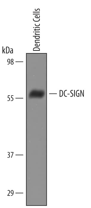 Western blot shows lysates of human dendritic cells. PVDF Membrane was probed with 1 µg/mL of Sheep Anti-Human DC-SIGN/CD209 Antigen Affinity-purified Polyclonal Antibody (Catalog # AF161) followed by HRP-conjugated Anti-Goat IgG Secondary Antibody (Catalog # HAF019). A specific band was detected for DC-SIGN/CD209 at approximately 50 kDa (as indicated). This experiment was conducted under reducing conditions and using Immunoblot Buffer Group 8.