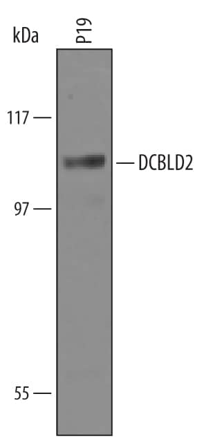 Western Blot DCBLD2/ESDN Antibody