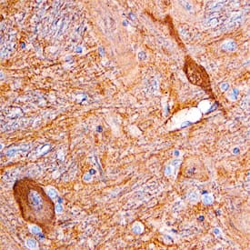 Immunohistochemistry Dimethylarginine Dimethylaminohydrolase 1/DDAH1 Antibody