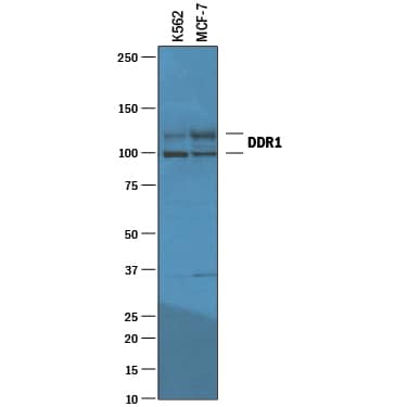 Western Blot DDR1 Antibody [Unconjugated]