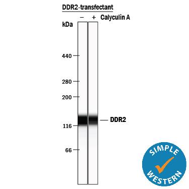 Simple Western lane view shows lysates of HEK293 human embryonic kidney cell line transfected with human DDR2 untreated (-) or treated (+) with Calyculin A for 10 minutes, loaded at 0.2 mg/mL. A specific band was detected for DDR2 at approximately 139 kDa (as indicated) using 2.5 µg/mL of Goat Anti-Human DDR2 Antigen Affinity-purified Polyclonal Antibody (Catalog # AF2538) followed by 1:50 dilution of HRP-conjugated Anti-Goat IgG Secondary Antibody (Catalog # HAF109). This experiment was conducted under reducing conditions and using the 12-230 kDa separation system.