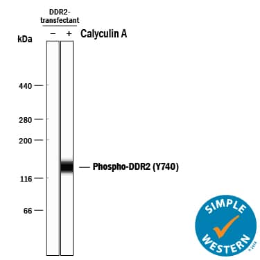 <b>Biological Strategies Validation. </b>Simple Western lane view shows lysates of HEK293 human embryonic kidney cell line transfected with human DDR2 untreated (-) or treated (+) with 100 nM Calyculin A (Catalog # 1336) for 10 minutes, loaded at 0.2 mg/mL. A specific band was detected for Phospho-DDR2 (Y740) at approximately 130 kDa (as indicated) using 1 µg/mL of Rabbit Anti-Human Phospho-DDR1/DDR2 (DDR1 Y796, DDR2 Y740) Monoclonal Antibody (Catalog # MAB25382). This experiment was conducted under reducing conditions and using the 66-440 kDa separation system.