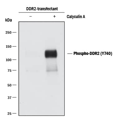 Western blot shows lysates of HEK293 human embryonic kidney cell line transfected with human DDR2 untreated (-) or treated (+) with 100 nM Calyculin A (Catalog # 1336) for 10 minutes. PVDF membrane was probed with 0.1 µg/mL of Rabbit Anti-Human Phospho-DDR1/DDR2 (DDR1 Y796, DDR2 Y740) Monoclonal Antibody (Catalog # MAB25382) followed by HRP-conjugated Anti-Rabbit IgG Secondary Antibody (Catalog # HAF008). A specific band was detected for Phospho-DDR2 (Y740) at approximately 120-130 kDa (as indicated). This experiment was conducted under reducing conditions and using Immunoblot Buffer Group 1.