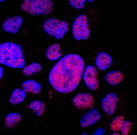 DDX17 was detected in immersion fixed A431 human epithelial carcinoma cell line using Goat Anti-Human DDX17 Antigen Affinity-purified Polyclonal Antibody (Catalog # AF4530) at 1 µg/mL for 3 hours at room temperature. Cells were stained using the NorthernLights™ 557-conjugated Anti-Goat IgG Secondary Antibody (red; Catalog # NL001) and counterstained with DAPI (blue). Specific staining was localized to nuclei. View our protocol for Fluorescent ICC Staining of Cells on Coverslips.