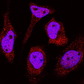 Immunocytochemistry DDX1 Antibody (2220A) [Unconjugated]
