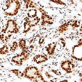 Immunohistochemistry DDX1 Antibody (2220A) [Unconjugated]