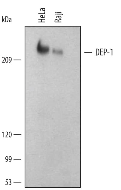 Western Blot DEP-1/CD148 Antibody (143-41)