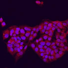 DGAT2 was detected in immersion fixed HepG2 human hepatocellular carcinoma cell line using Sheep Anti-Human DGAT2 Antigen Affinity-purified Polyclonal Antibody (Catalog # AF7256) at 10 µg/mL for 3 hours at room temperature. Cells were stained using the NorthernLights™ 557-conjugated Anti-Sheep IgG Secondary Antibody (red; Catalog # NL010) and counterstained with DAPI (blue). Specific staining was localized to cytoplasm. View our protocol for Fluorescent ICC Staining of Cells on Coverslips.