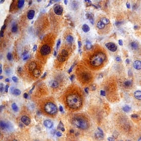 DGAT2 was detected in immersion fixed paraffin-embedded sections of human liver using Sheep Anti-Human DGAT2 Antigen Affinity-purified Polyclonal Antibody (Catalog # AF7256) at 3 µg/mL overnight at 4 °C. Before incubation with the primary antibody, tissue was subjected to heat-induced epitope retrieval using Antigen Retrieval Reagent-Basic (Catalog # CTS013). Tissue was stained using the Anti-Sheep HRP-DAB Cell & Tissue Staining Kit (brown; Catalog # CTS019) and counterstained with hematoxylin (blue). Specific staining was localized to cytoplasm of hepatocytes. View our protocol for Chromogenic IHC Staining of Paraffin-embedded Tissue Sections.