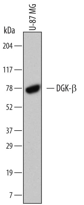 Western Blot DGK-beta Antibody (646523)