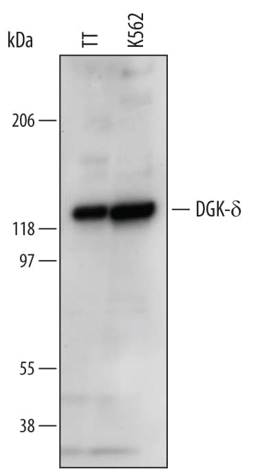 Western Blot DGK-delta Antibody (625423)
