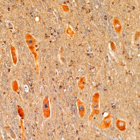 Immunohistochemistry DGK-epsilon Antibody