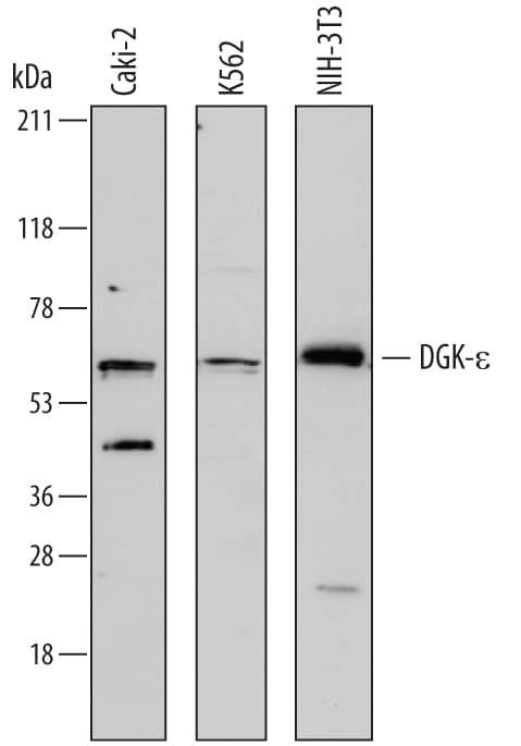 Western Blot DGK-epsilon Antibody
