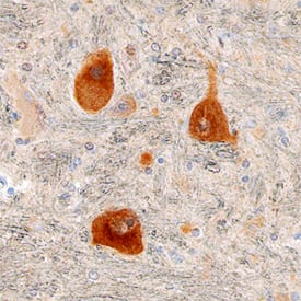 Immunohistochemistry DGK-epsilon Antibody (670914)