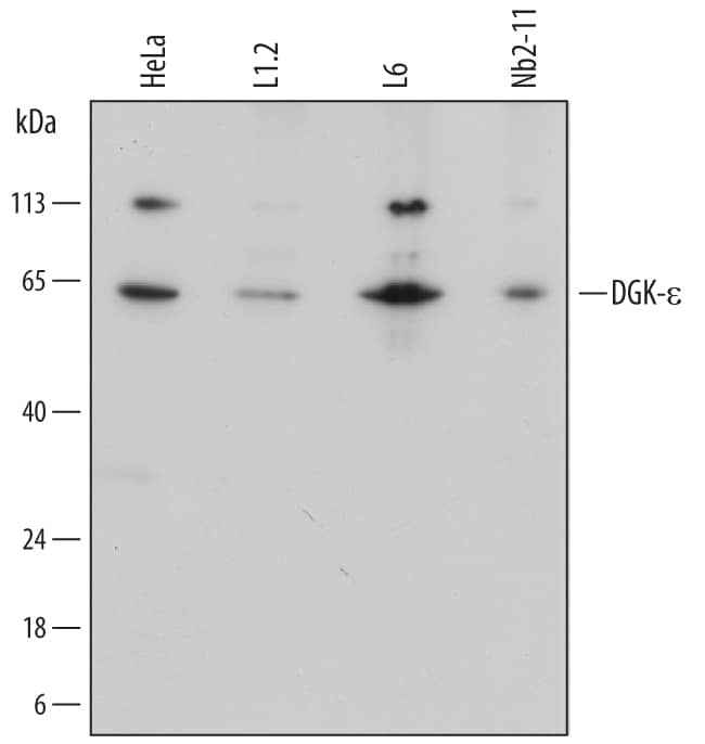 Western Blot DGK-epsilon Antibody (670914)