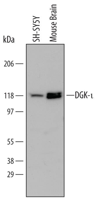 Western Blot DGK-iota Antibody (648538)