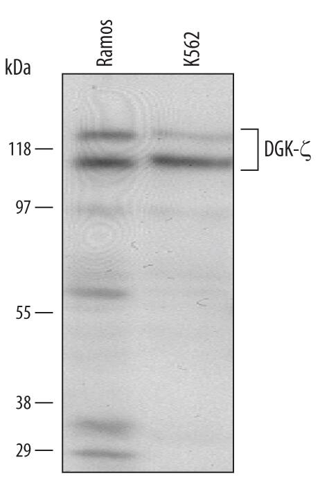 Western Blot DGK-zeta Antibody [Unconjugated]