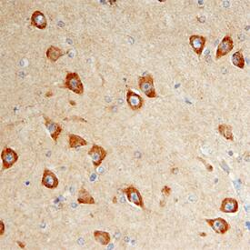 Immunohistochemistry DISC1 Antibody
