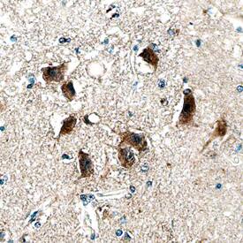 DISC1 was detected in immersion fixed paraffin-embedded sections of human brain (hippocampus) using Mouse Anti-Human DISC1 Monoclonal Antibody (Catalog # MAB6699) at 15 µg/mL overnight at 4 °C. Before incubation with the primary antibody, tissue was subjected to heat-induced epitope retrieval using Antigen Retrieval Reagent-Basic (Catalog # CTS013). Tissue was stained using the Anti-Mouse HRP-DAB Cell & Tissue Staining Kit (brown; Catalog # CTS002) and counterstained with hematoxylin (blue). Specific staining was localized to neuronal cell bodies. View our protocol for Chromogenic IHC Staining of Paraffin-embedded Tissue Sections.
