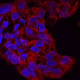 Immunocytochemistry DISP1 Antibody