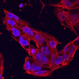 DISP1 was detected in immersion fixed BG01V human embryonic stem cells using Mouse Anti-Human DISP1 Monoclonal Antibody (Catalog # MAB3549) at 10 µg/mL for 3 hours at room temperature. Cells were stained using the NorthernLights™ 557-conjugated Anti-Mouse IgG Secondary Antibody (red; Catalog # NL007) and counterstained with DAPI (blue). Specific staining was localized to membrane structures and cytoplasm. View our protocol for Fluorescent ICC Staining of Cells on Coverslips.