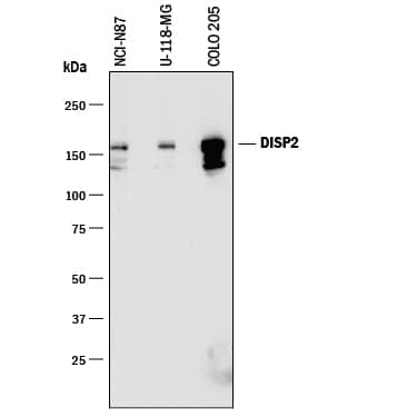 Western Blot DISP2 Antibody (758204)