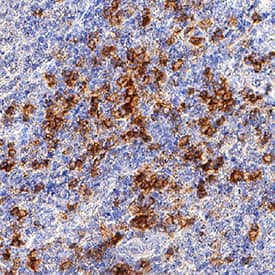 Immunohistochemistry DLEC/CLEC4C/BDCA-2 Antibody (992258) [Unconjugated]