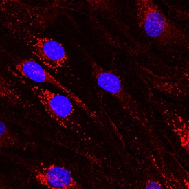 DLL4 was detected in immersion fixed bEnd.3 mouse endothelioma cell line using Goat Anti-Mouse DLL4 Antigen Affinity-purified Polyclonal Antibody (Catalog # AF1389) at 10 µg/mL for 3 hours at room temperature. Cells were stained using the NorthernLights™ 557-conjugated Anti-Goat IgG Secondary Antibody (red; Catalog # NL001) and counterstained with DAPI (blue). Specific staining was localized to cytoplasm. View our protocol for Fluorescent ICC Staining of Cells on Coverslips.