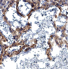 DLL4 was detected in immersion fixed paraffin-embedded sections of mouse embryo (13 d.p.c.) using Goat Anti-Mouse DLL4 Antigen Affinity-purified Polyclonal Antibody (Catalog # AF1389) at 5 µg/mL for 1 hour at room temperature followed by incubation with the Anti-Goat IgG VisUCyte™ HRP Polymer Antibody (Catalog # VC004). Tissue was stained using DAB (brown) and counterstained with hematoxylin (blue). Specific staining was localized to developing vasculature. View our protocol for IHC Staining with VisUCyte HRP Polymer Detection Reagents.