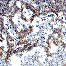 DLL4 was detected in immersion fixed frozen sections of mouse embryonic heart using Rat Anti-Human/Mouse DLL4 Monoclonal Antibody (Catalog # MAB1389) at 8 µg/mL overnight at 4 °C. Tissue was stained using the Anti-Rat HRP-DAB Cell & Tissue Staining Kit (brown; Catalog # CTS017) and counterstained with hematoxylin (blue). Specific staining was localized to developing cardiomyocytes. View our protocol for Chromogenic IHC Staining of Frozen Tissue Sections.