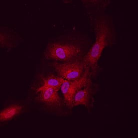 DLL4 was detected in immersion fixed HUVEC human umbilical vein endothelial cells using Rat Anti-Human DLL4 Monoclonal Antibody (Catalog # MAB1506) at 10 µg/mL for 3 hours at room temperature. Cells were stained using the NorthernLights™ 557-conjugated Anti-Rat IgG Secondary Antibody (red; Catalog # NL013) and counterstained with DAPI (blue). Specific staining was localized to cell surfaces and cytoplasm. View our protocol for Fluorescent ICC Staining of Cells on Coverslips.